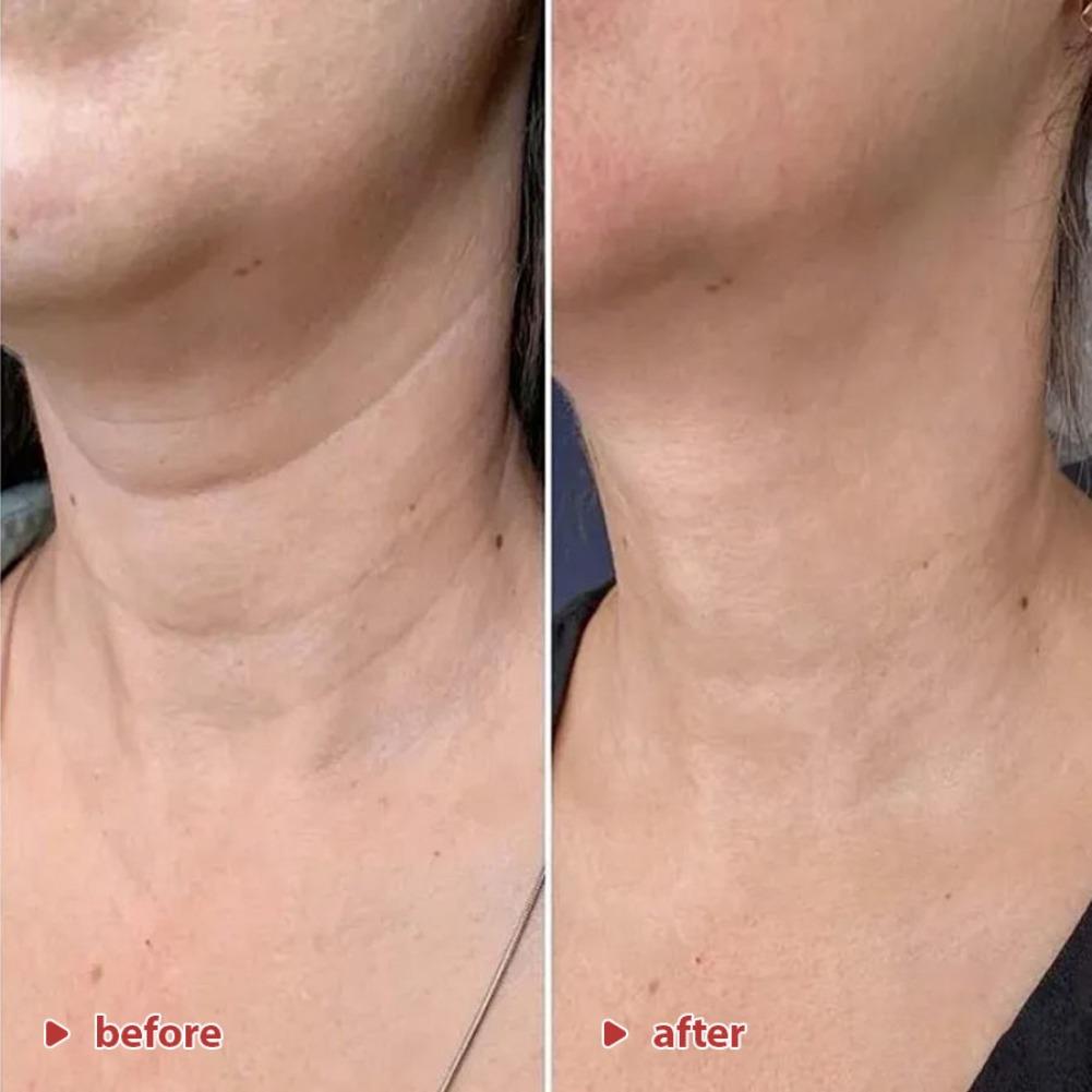 Creme para Pescoço Coreano Kor - Peptide Neck Cream avaliação e preço